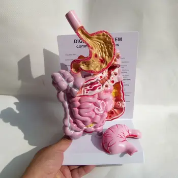 Анатомическая модель пищеварительной системы человека, модель толстой кишки, модель прямой кишки, двенадцатиперстной кишки, внутренних органов, кишечника и желудка